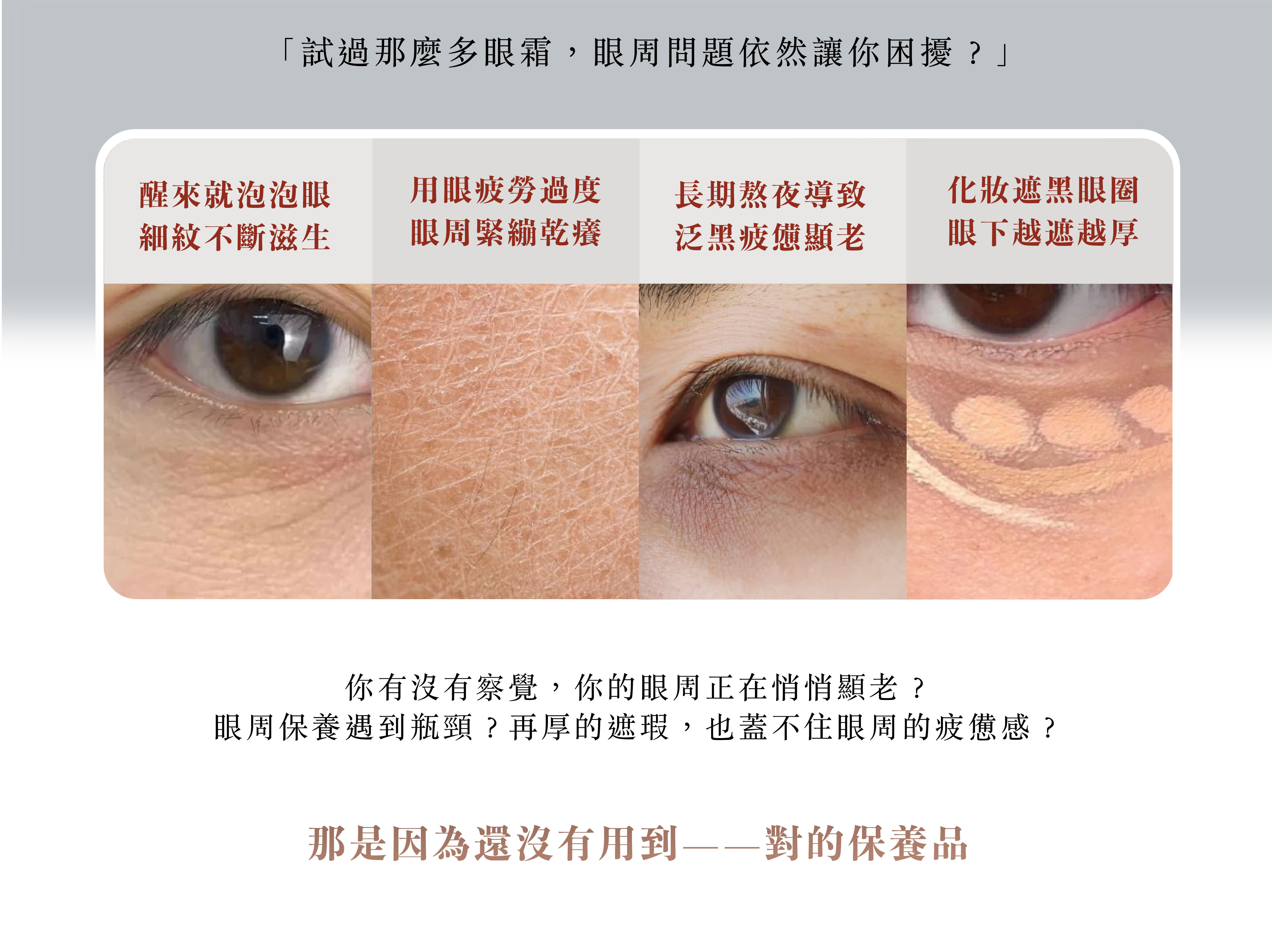 眼周常見困擾與保養需求